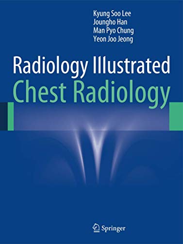9783642370953: Radiology Illustrated: Chest Radiology