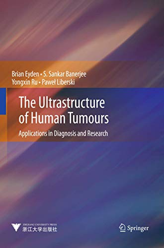 The Ultrastructure of Human Tumours: Applications in Diagnosis and Research (9783642391675) by Eyden, Brian; Banerjee, S. Sankar; Ru, Yongxin; Liberski, PaweÅ‚