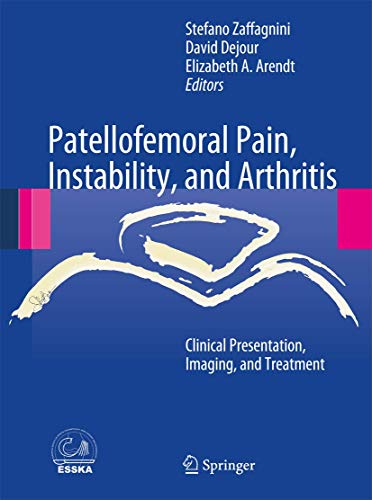 9783642423246: Patellofemoral Pain, Instability, and Arthritis: Clinical Presentation, Imaging, and Treatment