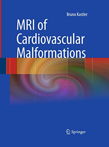 Stock image for MRI of Cardiovascular Malformations for sale by Buchpark