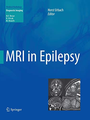 9783642438417: MRI in Epilepsy (Medical Radiology)