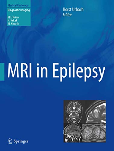 9783642438417: MRI in Epilepsy