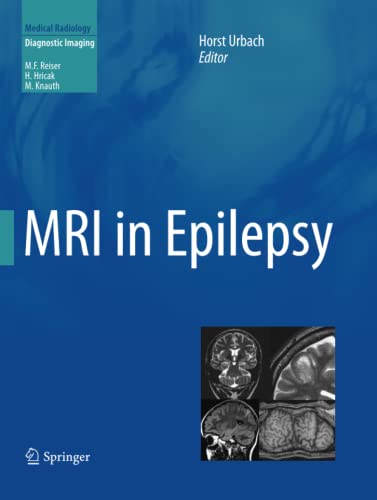 9783642438417: MRI in Epilepsy