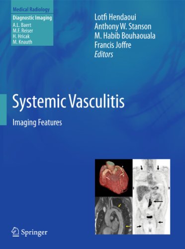 Stock image for Systemic Vasculitis: Imaging Features (Medical Radiology) for sale by GF Books, Inc.