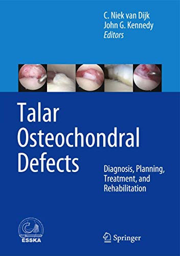 Beispielbild fr Talar Osteochondral Defects zum Verkauf von Blackwell's