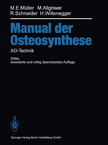 Stock image for Manual der OSTEOSYNTHESE: AO-Technik (German Edition) for sale by Lucky's Textbooks