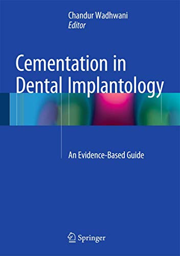 Beispielbild fr Cementation in Dental Implantology: An Evidence-Based Guide zum Verkauf von Chiron Media