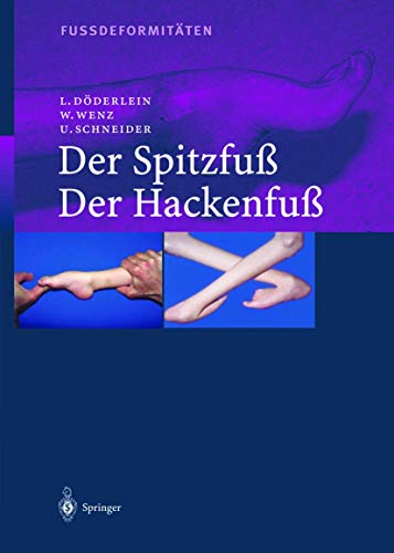 9783642622069: Fussdeformitten: Der Spitzfuss/Der Hackenfuss