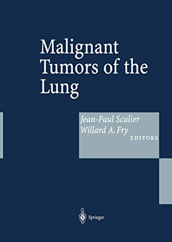 9783642622533: Malignant Tumors of the Lung: Evidence-based Management