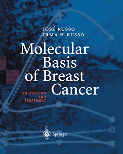 9783642622700: Molecular Basis of Breast Cancer: Prevention And Treatment