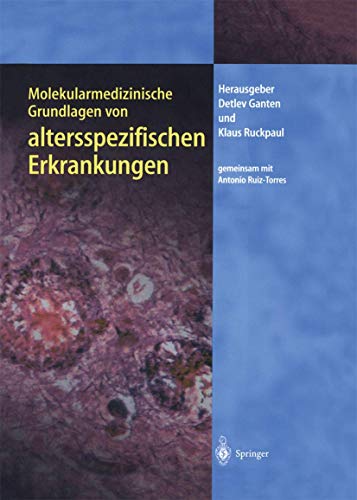 Stock image for Molekularmedizinische Grundlagen von altersspezifischen Erkrankungen Molekulare Medizin [Gebundene Ausgabe] Molekularbiologie Zytogenetik erbliche Erkrankungen Krebsstatistik Diagnostik Therapie hmatologische Neoplasien Leukmie Lymphome Chromosomenbruch Immundefizienz-Syndrome Identifizierung Krankheitsgene molekularbiologische zytogenetische Methoden Detlev Ganten (Autor), Klaus Ruckpaul (Autor), Antonio Ruiz-Torres (Autor) for sale by BUCHSERVICE / ANTIQUARIAT Lars Lutzer