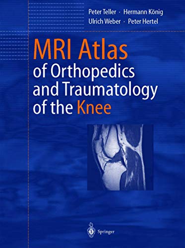 Stock image for MRI Atlas of Orthopedics and Traumatology of the Knee for sale by Ria Christie Collections