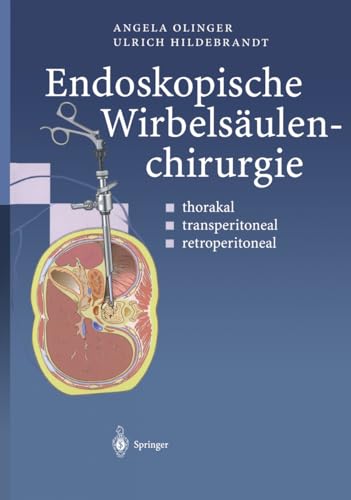 9783642630583: Endoskopische Wirbelsulenchirurgie: Thorakal  Transperitoneal  Retroperitoneal (German Edition)