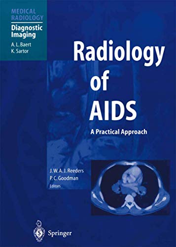 9783642630606: Radiology of AIDS (Medical Radiology)