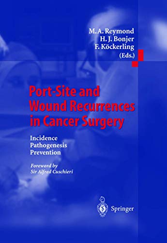 9783642631177: Port-Site and Wound Recurrences in Cancer Surgery: Incidence - Pathogenesis - Prevention