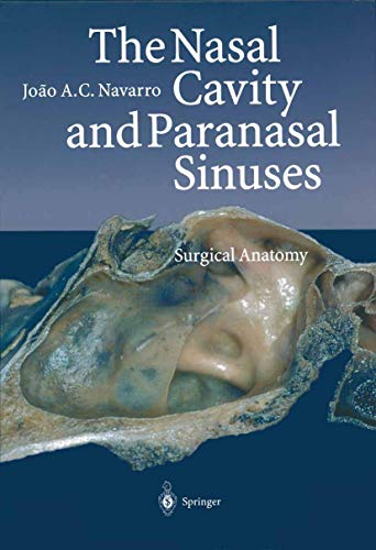 9783642631870: The Nasal Cavity and Paranasal Sinuses: Surgical Anatomy