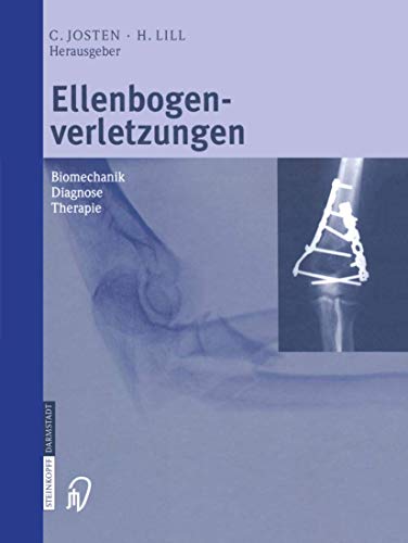 Ellenbogenverletzungen: Biomechanik   Diagnose   Therapie (German Edition)