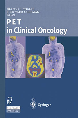 9783642633294: Pet in Clinical Oncology
