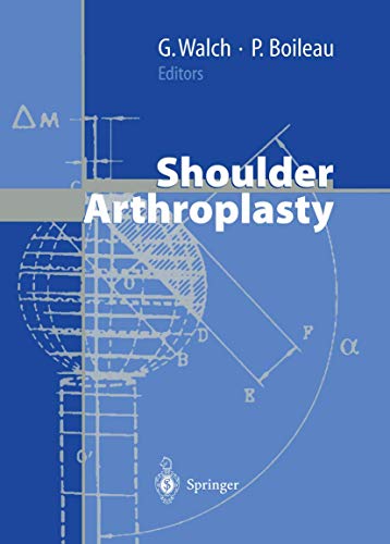 Beispielbild fr Shoulder Arthroplasty zum Verkauf von Book Deals