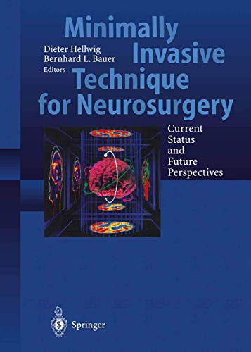 9783642637018: Minimally Invasive Techniques for Neurosurgery