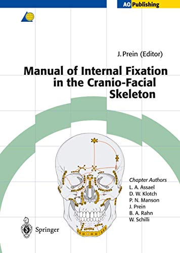 9783642637322: Manual of Internal Fixation in the Cranio-Facial Skeleton: Techniques Recommended By The Ao/Asif Maxillofacial Group