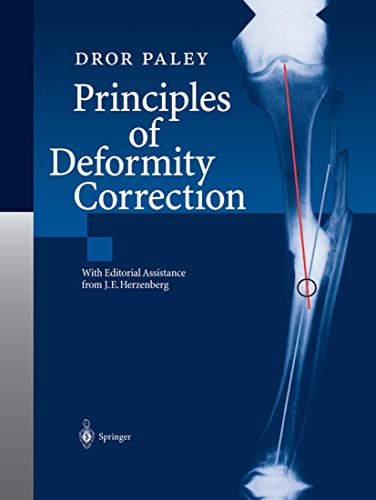 9783642639531: Principles of Deformity Correction