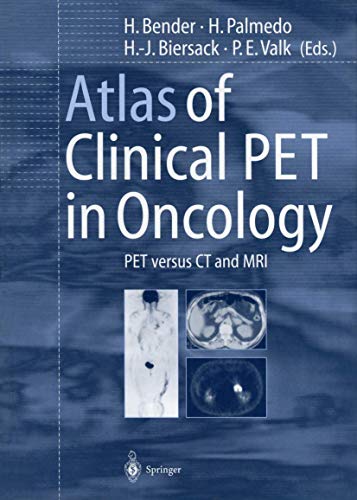 Stock image for Atlas of Clinical Pet in Oncology for sale by Kennys Bookshop and Art Galleries Ltd.