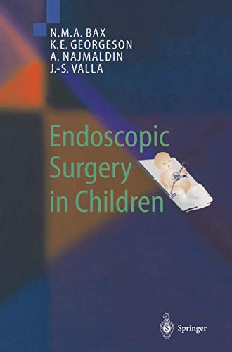 Beispielbild fr Endoscopic Surgery in Children. zum Verkauf von Gast & Hoyer GmbH