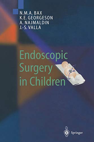 Imagen de archivo de Endoscopic Surgery in Children. a la venta por Gast & Hoyer GmbH