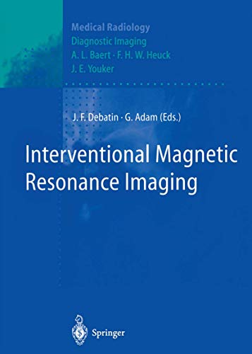 Imagen de archivo de Interventional Magnetic Resonance Imaging a la venta por Revaluation Books