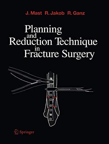 Beispielbild fr Planning and Reduction Technique in Fracture Surgery zum Verkauf von Revaluation Books