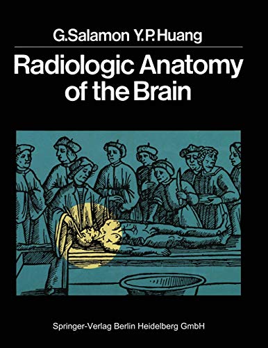 9783642662751: Radiologic Anatomy of the Brain