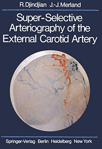 Super-Selective Arteriography of the External Carotid Artery - Rene Djindjian|J.-J. Merland