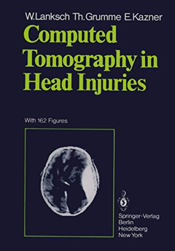 9783642674235: Computed Tomography in Head Injuries