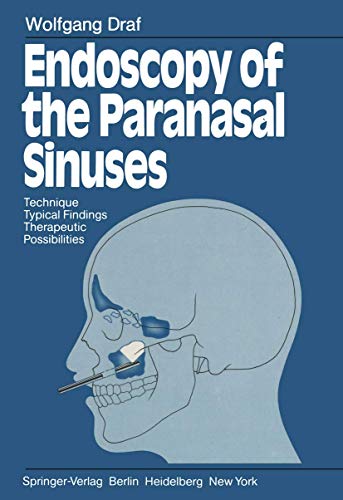 Stock image for Endoscopy of the Paranasal Sinuses: Technique  Typical Findings Therapeutic Possibilities for sale by AwesomeBooks