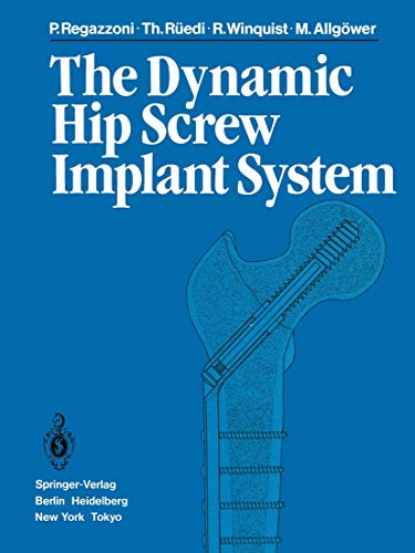 Beispielbild fr The Dynamic Hip Screw Implant System zum Verkauf von Lucky's Textbooks