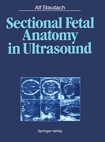 Imagen de archivo de Sectional Fetal Anatomy in Ultrasound a la venta por suffolkbooks