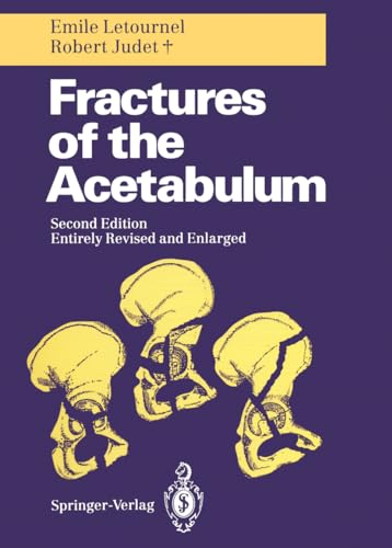 9783642754371: Fractures of the Acetabulum