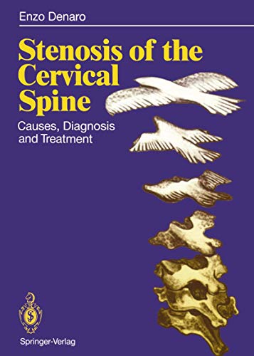 9783642762055: Stenosis of the Cervical Spine: Causes, Diagnosis and Treatment