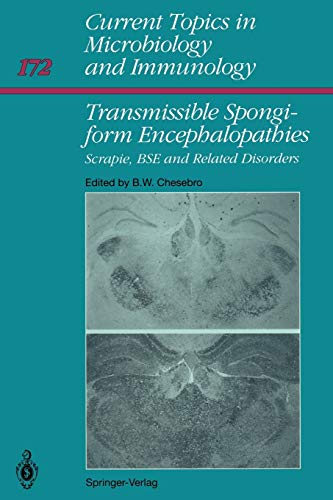 Stock image for Transmissible Spongiform Encephalopathies:: Scrapie, BSE and Related Human Disorders (Current Topics in Microbiology and Immunology, 172) for sale by Lucky's Textbooks