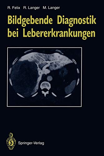 Stock image for Bildgebende Diagnostik Bei Lebererkrankungen for sale by Revaluation Books
