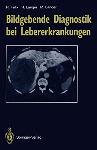 9783642777844: Bildgebende Diagnostik bei Lebererkrankungen (Delaware Edition)