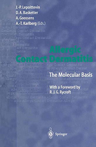 9783642803338: Allergic Contact Dermatitis: The Molecular Basis