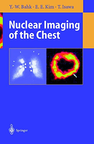 Stock image for Nuclear Imaging of the Chest for sale by Lucky's Textbooks