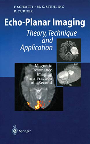 Stock image for Echo-Planar Imaging: Theory, Technique and Application for sale by Lucky's Textbooks