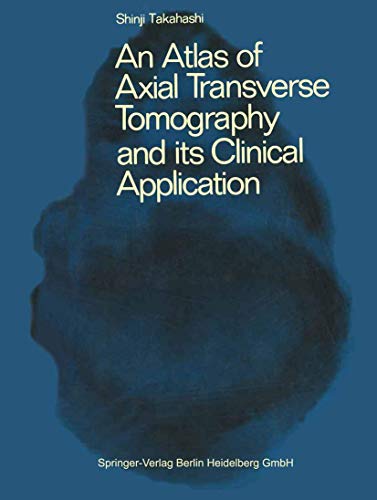 An Atlas of Axial Transverse Tomography and its Clinical Application - A. S. Takahashi