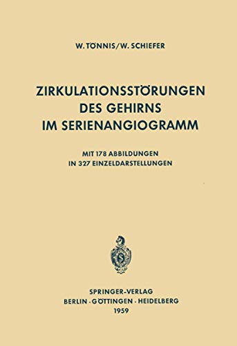 9783642887352: Zirkulationsstrungen des Gehirns im Serienangiogramm (German Edition)