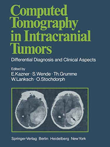 9783642966552: Computed Tomography in Intracranial Tumors: Differential Diagnosis and Clinical Aspects