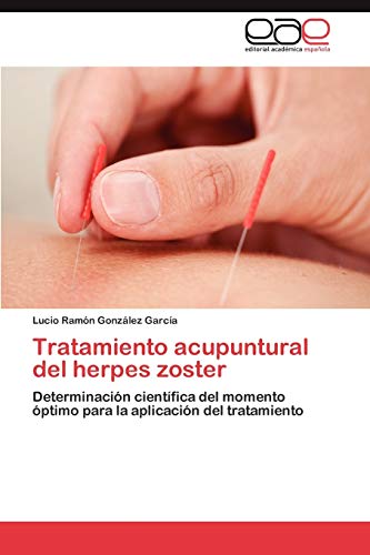 9783659019319: Tratamiento acupuntural del herpes zoster: Determinacin cientfica del momento ptimo para la aplicacin del tratamiento
