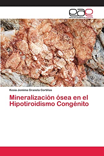 Imagen de archivo de Mineralizacion osea en el Hipotiroidismo Congenito a la venta por Chiron Media